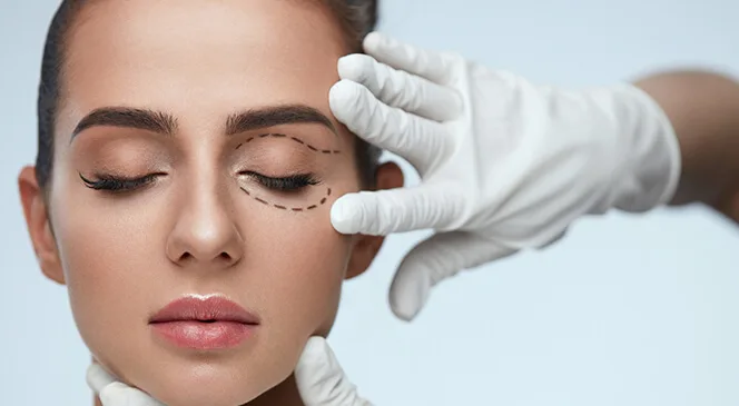 oculoplastia intervención