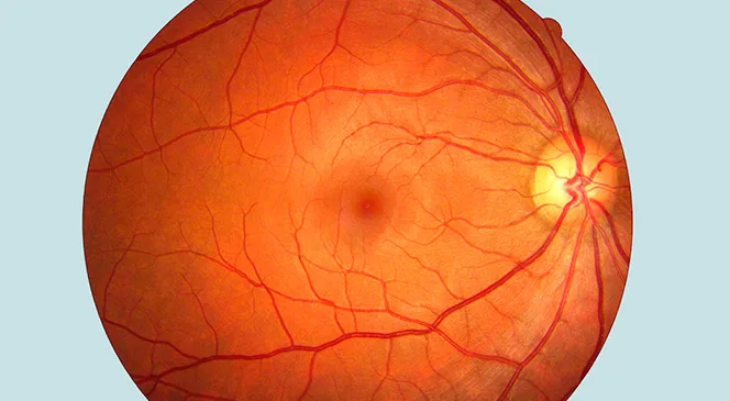Retina