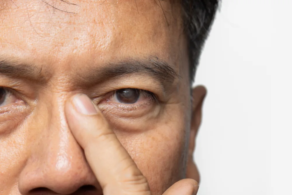 AGUJERO MACULAR - CAUSAS