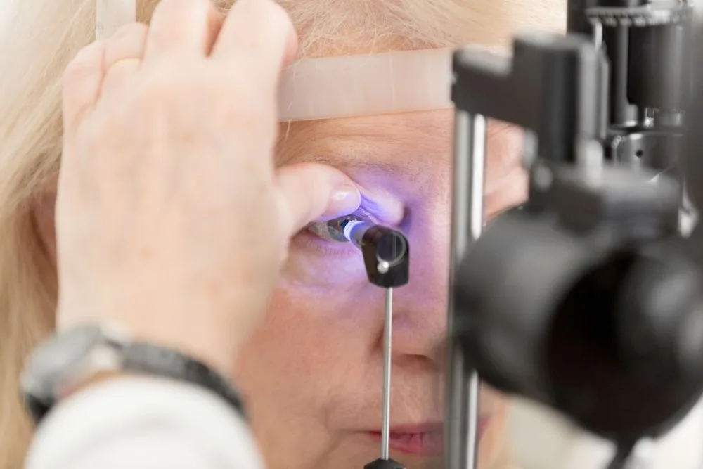 GLAUCOMA - CAUSAS