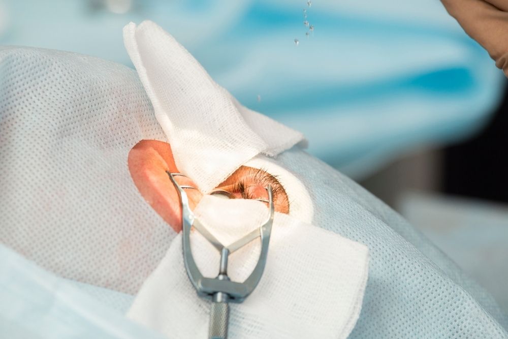 CIRUGÍA DE CATARATA - Facoemulsificación