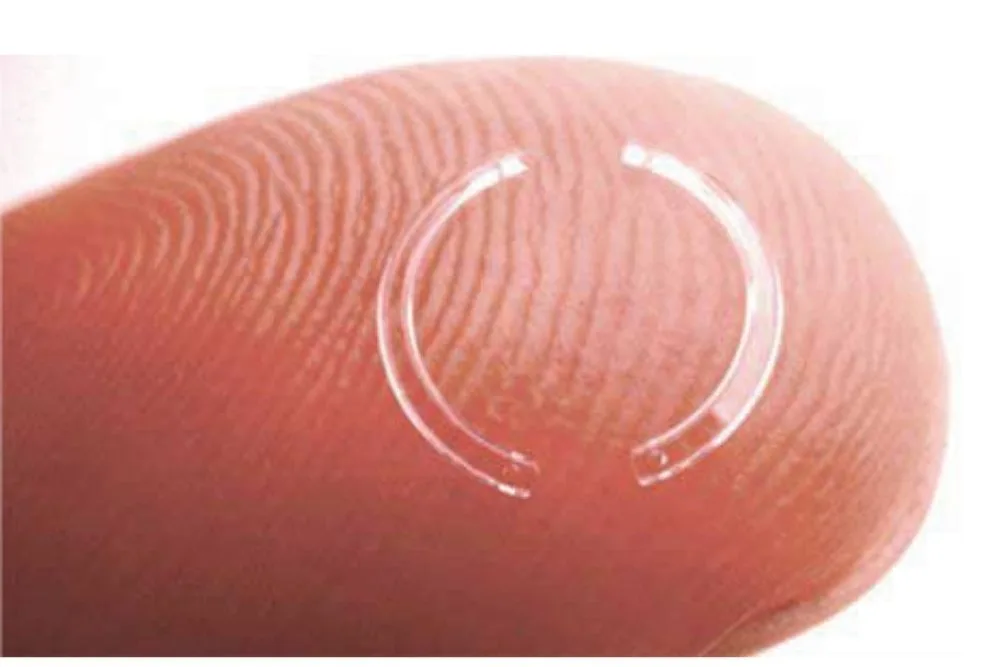 CIRUGÍA CORNEA - ANILLO INTRACORNEAL