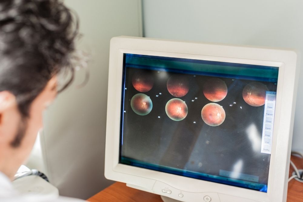 CIRUGÍA DE RETINA - TÉCNICAS