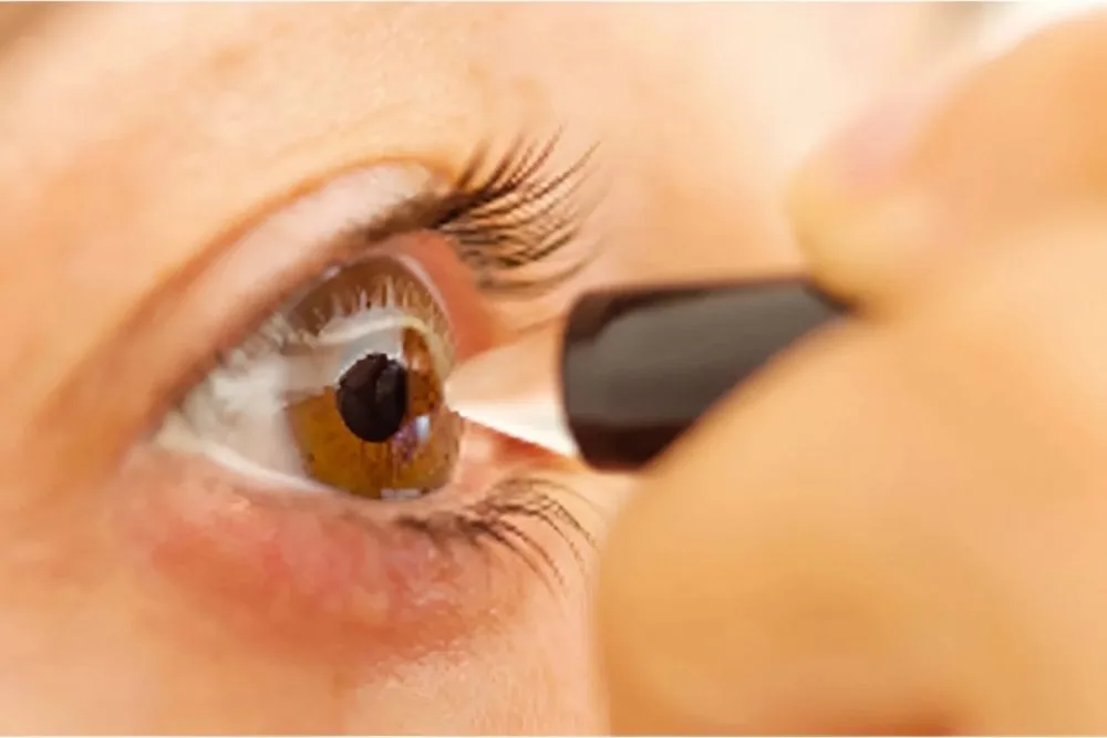Paquimetría Corneal