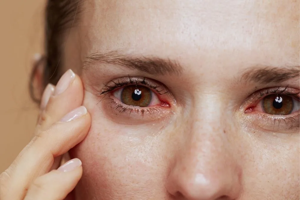 UVEITIS- CAUSAS