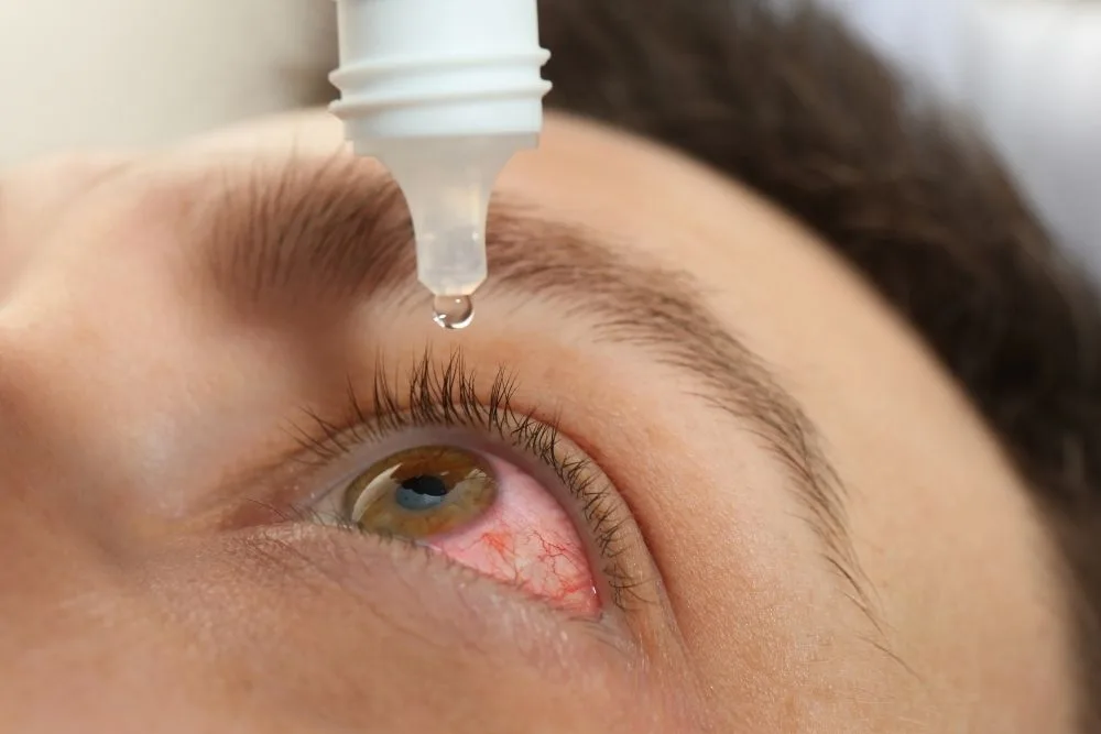 UVEITIS TRATAMIENTO
