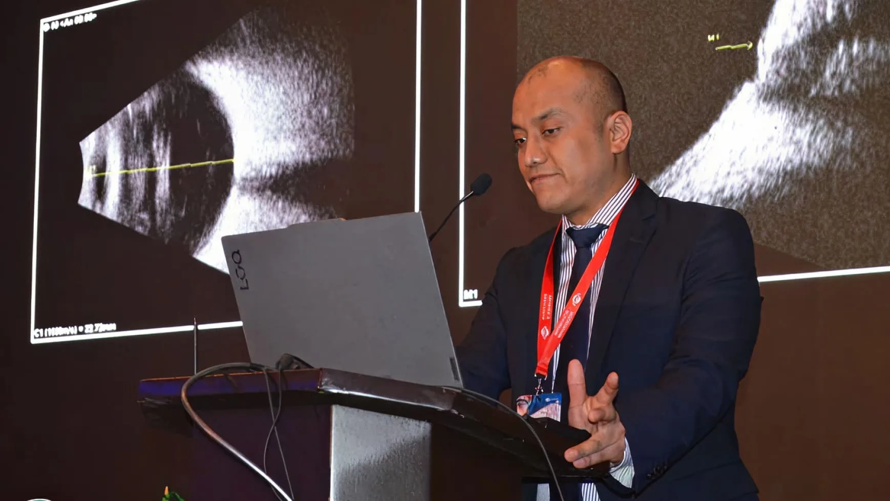 Congreso Internacional de Retina
