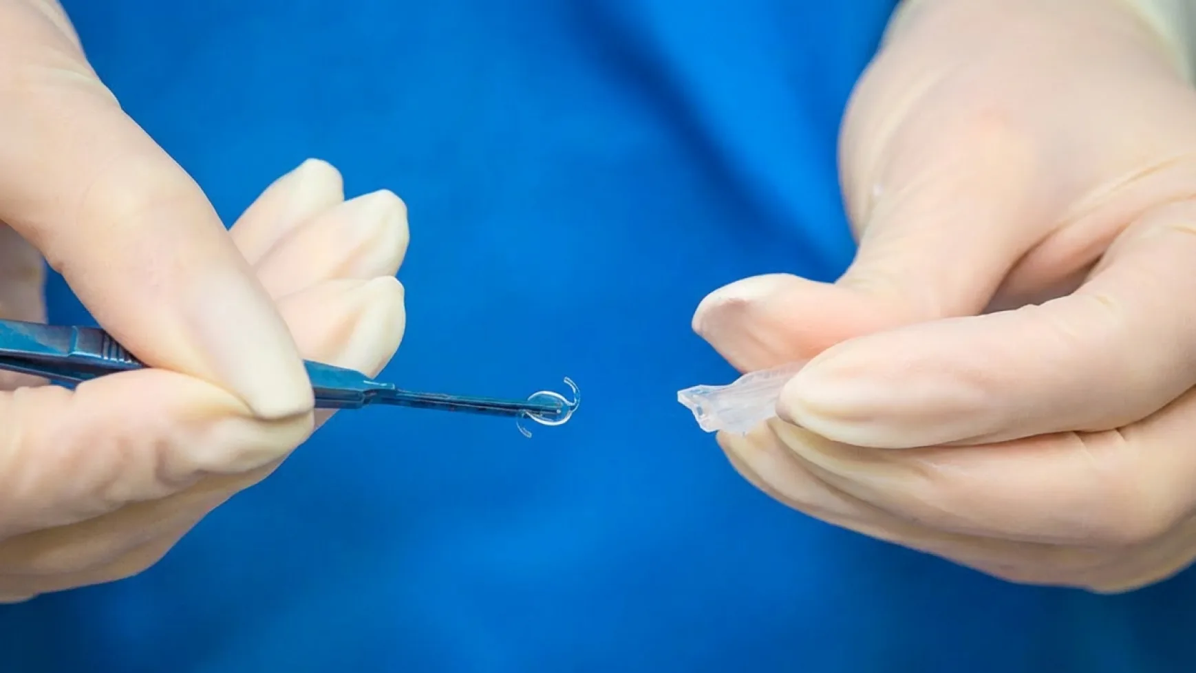 cataratas sintomas iniciales