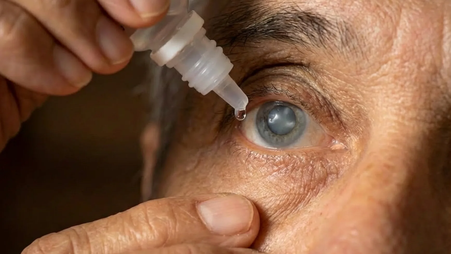 Glaucoma: el ladrón silencioso de la visión, cómo detectarlo a tiempo
