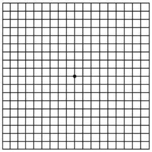 test de amsler