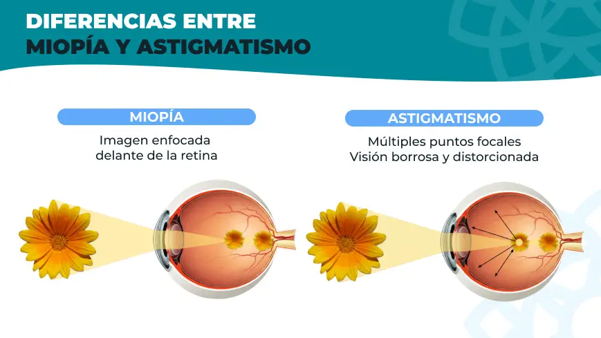 diferencias entre miopía y astigmatismo