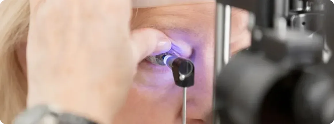 causas del glaucoma
