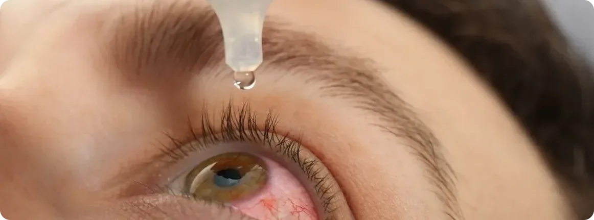 tratamiento de uveitis