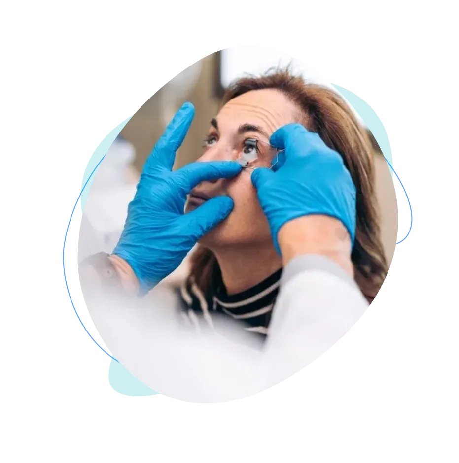 beneficios de operarse de la cornea