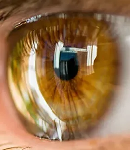 cirugia de cornea
