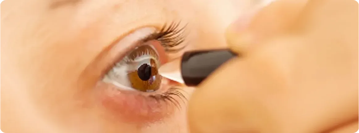 paquimetria corneal