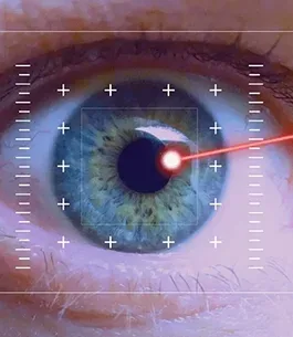 procedimientos laser para la vista