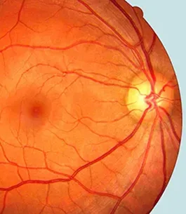 operaciones de retinas