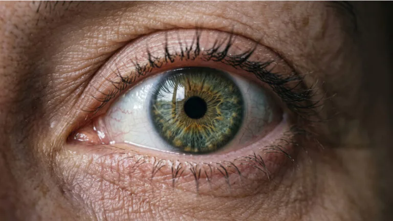Primer plano del ojo de un paciente adulto, relevante para la evaluación de glaucoma