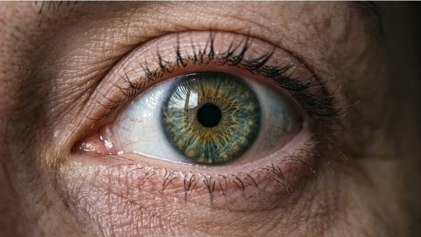 Primer plano del ojo de un paciente adulto, relevante para la evaluación de glaucoma